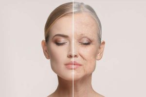 Rejuvenarea facială sau cum să arăți mai tânăr - Doctor SKiN