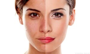 Începe curățenia de VARĂ! Strălucește cu Venus Glow™ ! - Doctor SKiN