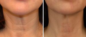 Ti-ar plăcea să arăți spectaculos chiar și fără machiaj? Volite este solutia! - Doctor SKiN