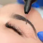 PlasmAge® - Blefaroplastie și tratament pentru imperfecțiunile pielii fără bisturiu - Doctor SKiN