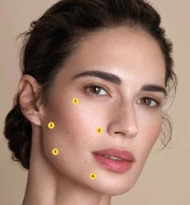 Profhilo: remodelarea bio a feței, gâtului, decolteului și mâinilor - Doctor SKiN