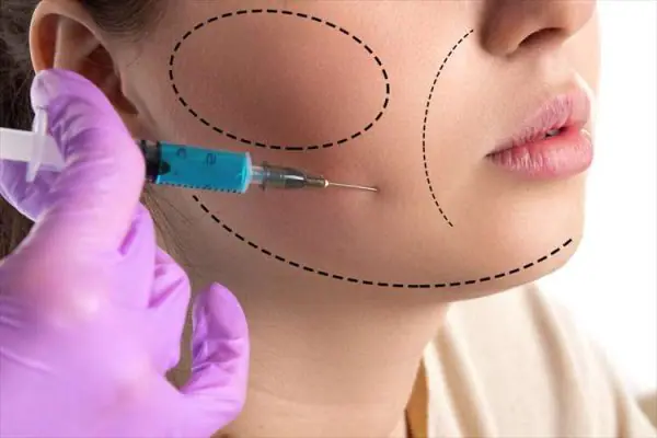 Lipoliza sau topirea grăsimii prin injectare