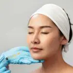 Topirea acidului hialuronic cu hialuronidază - Doctor SKiN