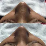 Curățare & Exfoliere - Doctor SKiN Curățare & Exfoliere - Doctor SKiN