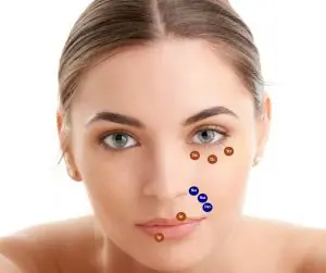 Tehnica de injectare MD Codes - Doctor SKiN