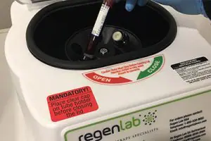 PRP RegenLab - Doctor SKiN