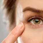 tratament cearcăne întunecate peeling chimic