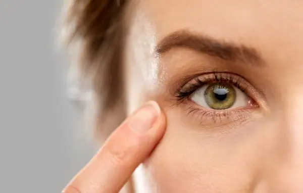 tratament cearcăne întunecate peeling chimic