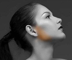 epilare definitiva faciala