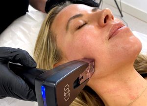 Morpheus 8 - Skin MedSpa