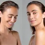 PhilArt: rejuvenare și biorevitalizare pe bază de PDRN