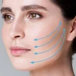 lifting facial cu fire Aptos Doctor SKiN