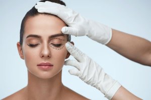 Blefaroplastia chirurgicala, Operație ridicare pleoape