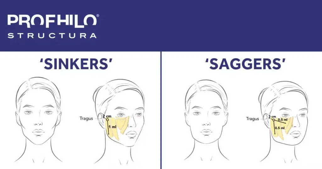 Profhilo® Structura: regenerare, rejuvenare și lifting facial cu aspect 100% natural - Doctor SKiN Profhilo® Structura: regenerare, rejuvenare și lifting facial cu aspect 100% natural - Doctor SKiN
