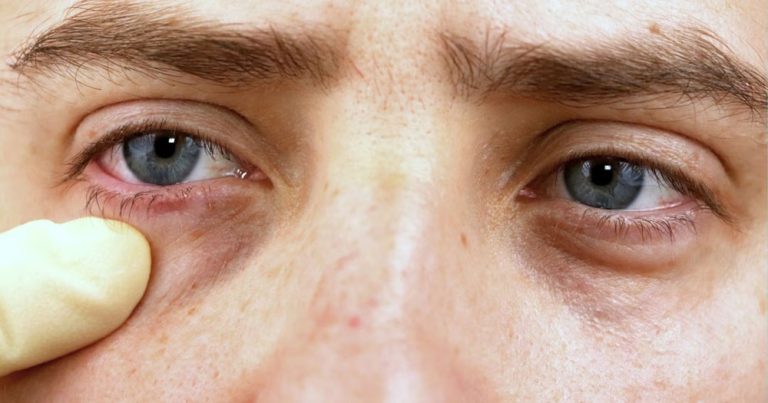 Piennedi Strong – Polinucleotide + Acid Hialuronic pentru regenerare profundă, hidratare și fermitate - Doctor SKiN Piennedi Strong – Polinucleotide + Acid Hialuronic pentru regenerare profundă, hidratare și fermitate - Doctor SKiN