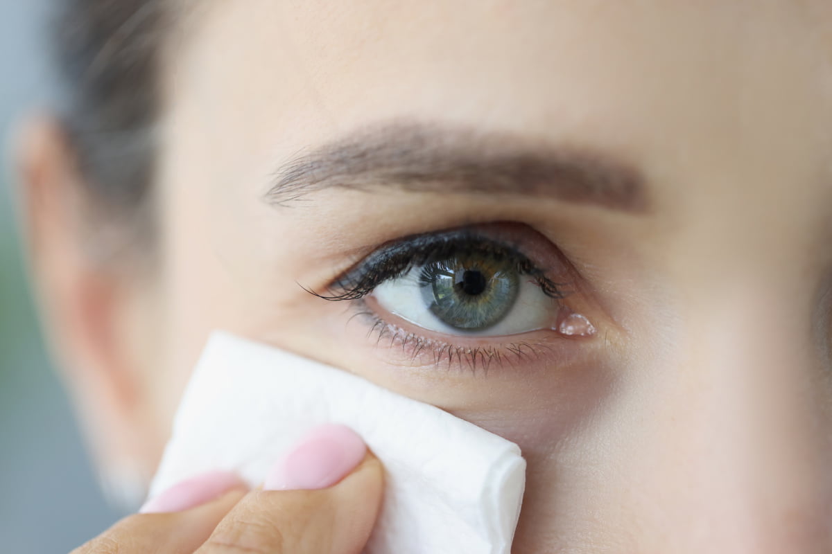 De ce îmi apar vânătăi după injectarea cu Acid Hialuronic și Toxină Botulinică? - Doctor SKiN
