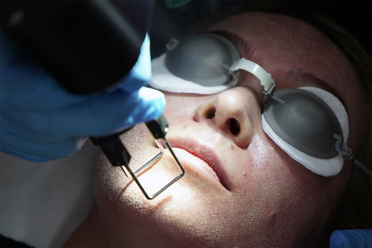 Platforme laser