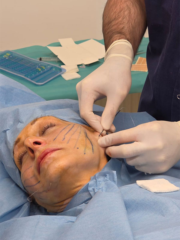 Lifting facial cu fire Aptos - Doctor SKiN Lifting facial cu fire Aptos - Doctor SKiN