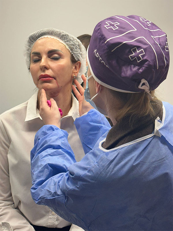 Lifting facial cu fire Aptos - Doctor SKiN Lifting facial cu fire Aptos - Doctor SKiN