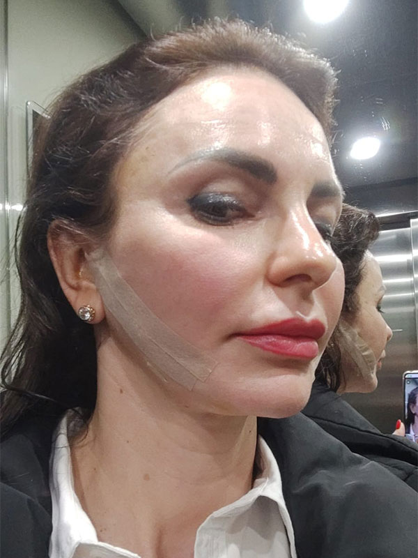 Lifting facial cu fire Aptos - Doctor SKiN Lifting facial cu fire Aptos - Doctor SKiN